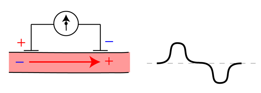 B.3.3. Basis Principes ECG. – BasisFysiologie.nl